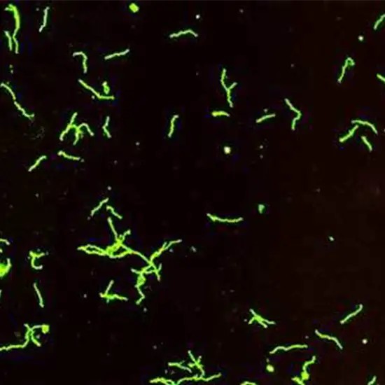 Fluorescent Treponemal Antibody-Absorption FTA-ABS Test
